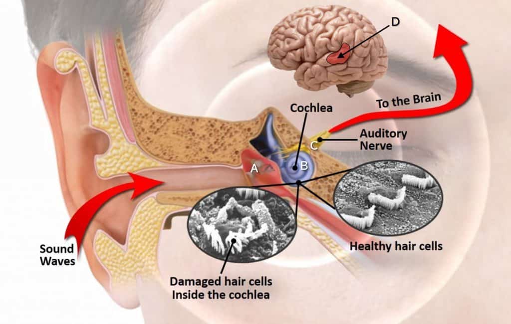 tms-for-tinnitus-alimran-medical-center